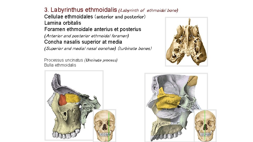 3. Labyrinthus ethmoidalis (Labyrinth of ethmoidal bone) Cellulae ethmoidales (anterior and posterior) Lamina orbitalis 3. Labyrinthus ethmoidalis (Labyrinth of ethmoidal bone) Cellulae ethmoidales (anterior and posterior) Lamina orbitalis