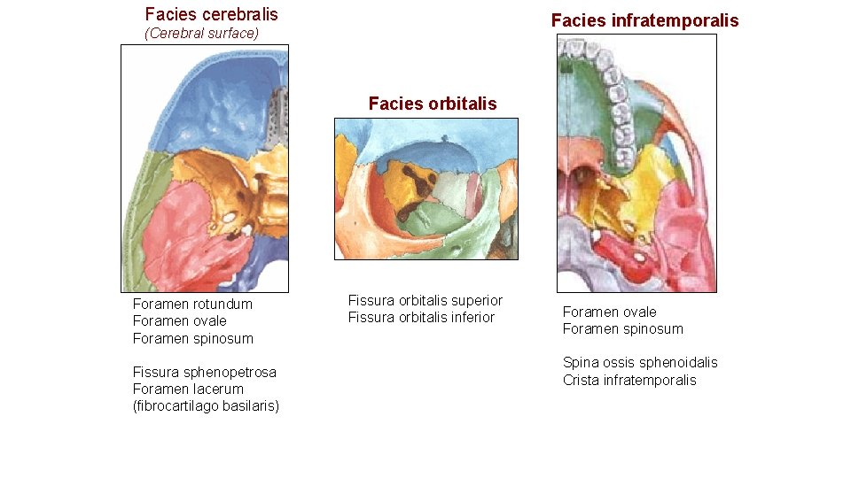 Facies cerebralis Facies infratemporalis (Cerebral surface) Facies orbitalis Foramen rotundum Foramen ovale Foramen spinosum Facies cerebralis Facies infratemporalis (Cerebral surface) Facies orbitalis Foramen rotundum Foramen ovale Foramen spinosum