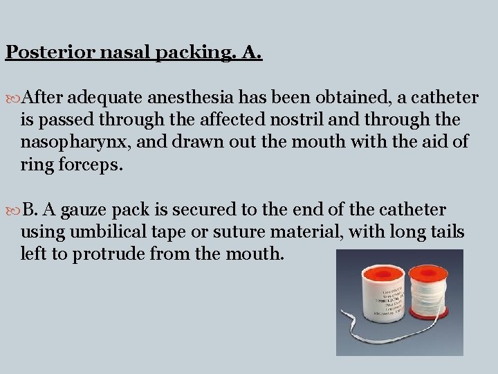 Posterior nasal packing. A. After adequate anesthesia has been obtained, a catheter is passed