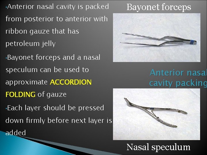  • Anterior nasal cavity is packed Bayonet forceps from posterior to anterior with
