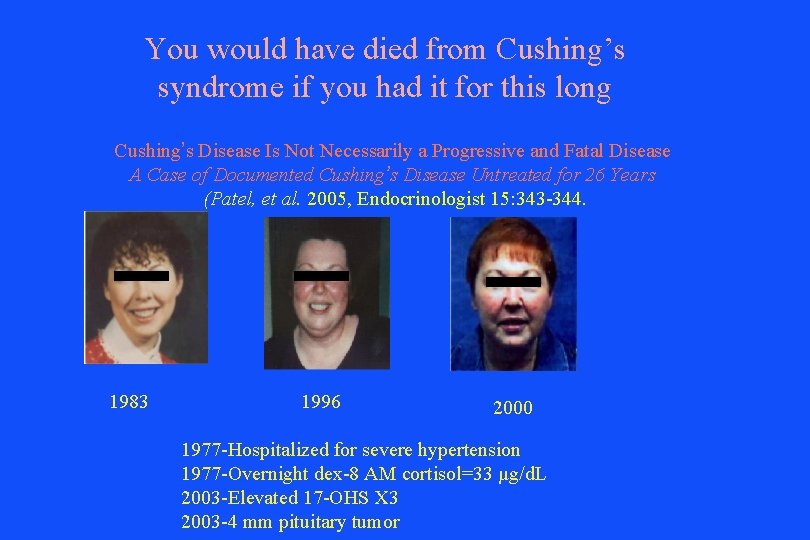 You would have died from Cushing’s syndrome if you had it for this long