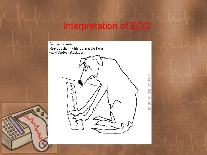 Interpretation of ECG 