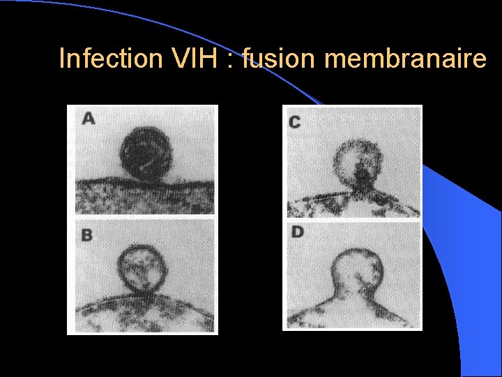 Infection VIH : fusion membranaire 