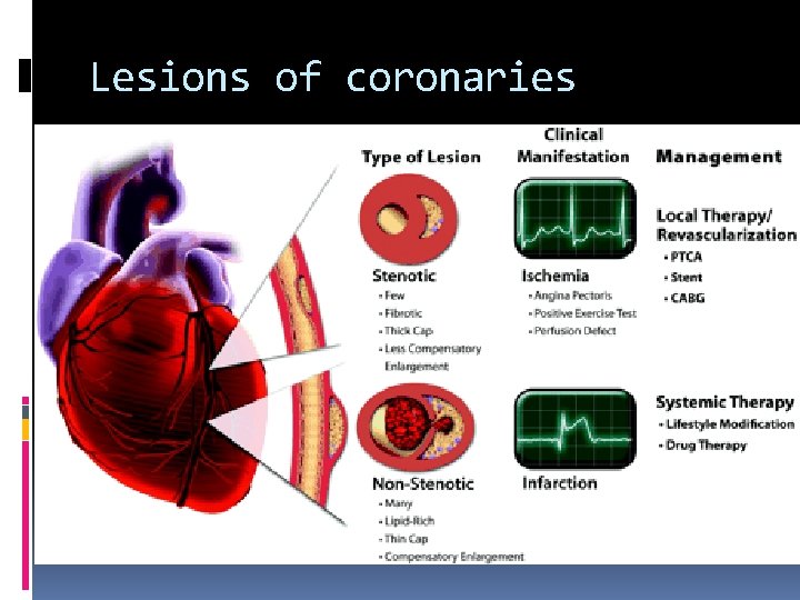 Lesions of coronaries 