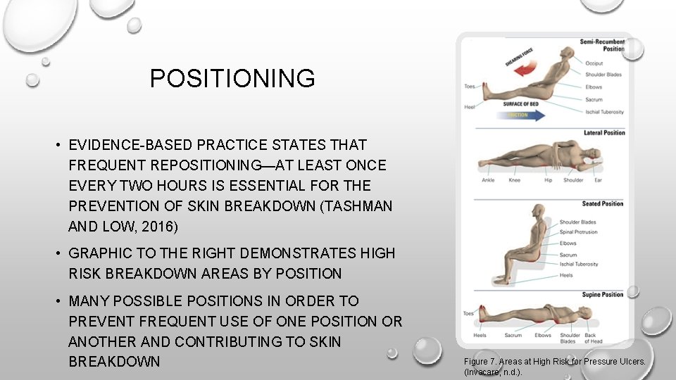 POSITIONING • EVIDENCE-BASED PRACTICE STATES THAT FREQUENT REPOSITIONING—AT LEAST ONCE EVERY TWO HOURS IS