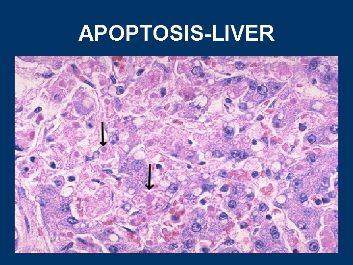 APOPTOSIS-LIVER 