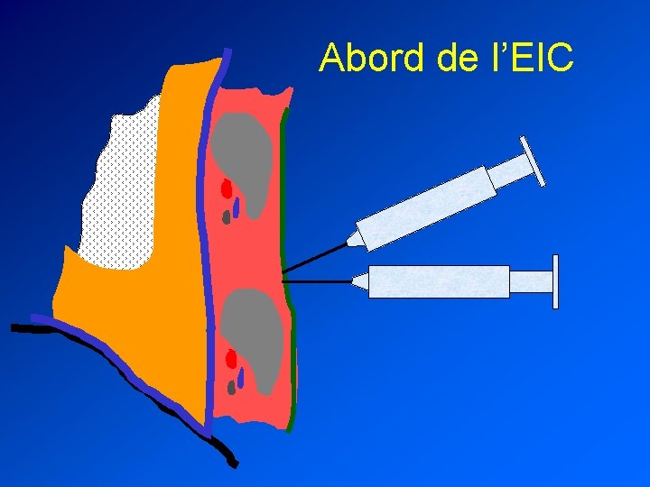 Abord de l’EIC 