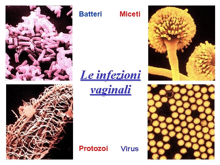 Batteri Miceti Le infezioni vaginali Protozoi Virus 