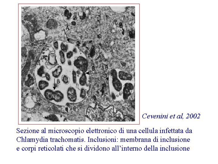 Cevenini et al, 2002 Sezione al microscopio elettronico di una cellula infettata da Chlamydia