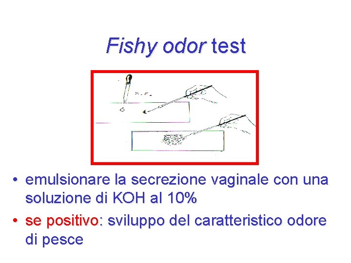 Fishy odor test • emulsionare la secrezione vaginale con una soluzione di KOH al