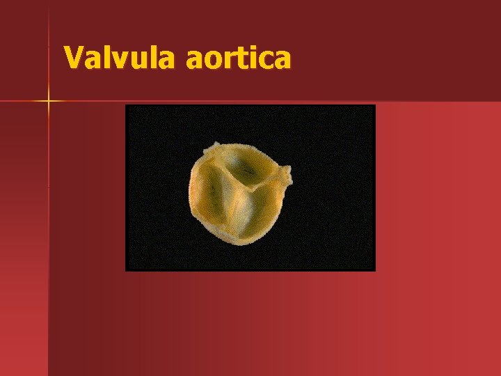 Valvula aortica 