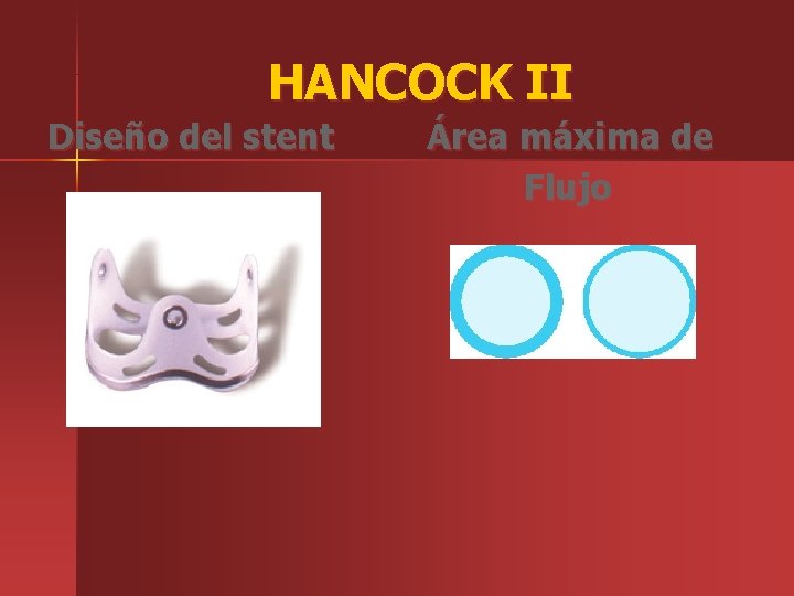 HANCOCK II Diseño del stent Área máxima de Flujo 