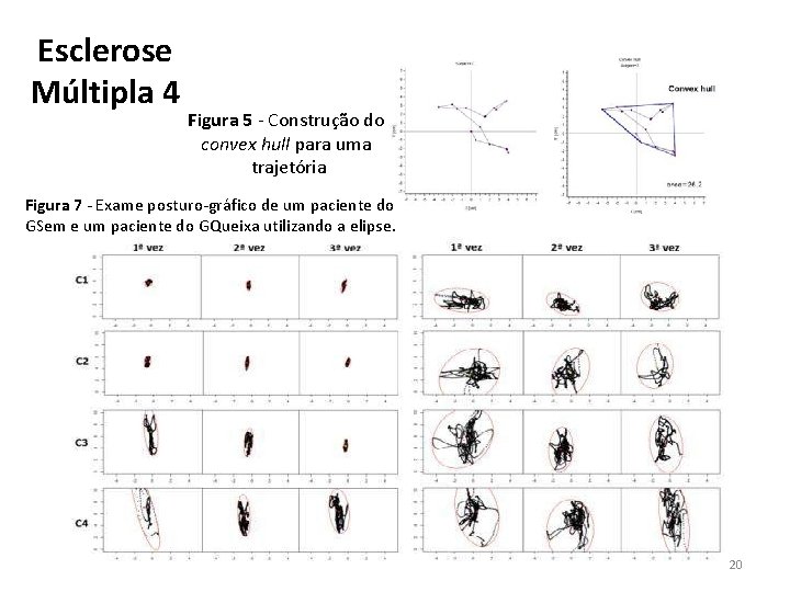 Esclerose Múltipla 4 Figura 5 - Construção do convex hull para uma trajetória Figura