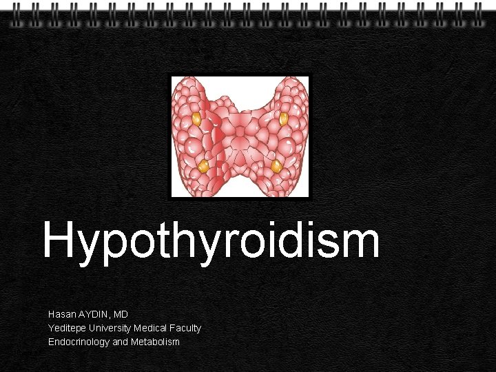 Hypothyroidism Hasan AYDIN, MD Yeditepe University Medical Faculty Endocrinology and Metabolism Page 