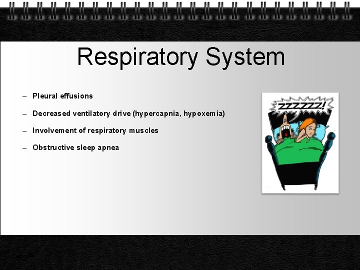 Respiratory System – Pleural effusions – Decreased ventilatory drive (hypercapnia, hypoxemia) – Involvement of