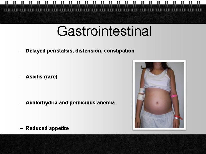 Gastrointestinal – Delayed peristalsis, distension, constipation – Ascitis (rare) – Achlorhydria and pernicious anemia