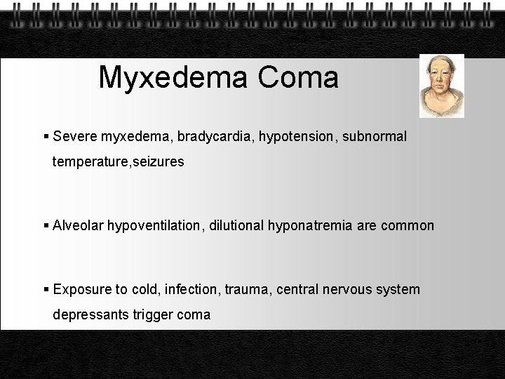 Myxedema Coma Severe myxedema, bradycardia, hypotension, subnormal temperature, seizures Alveolar hypoventilation, dilutional hyponatremia are