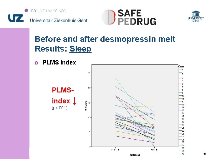 Before and after desmopressin melt Results: Sleep PLMS index PLMSindex ↓ (p<. 001) © Before and after desmopressin melt Results: Sleep PLMS index PLMSindex ↓ (p<. 001) ©
