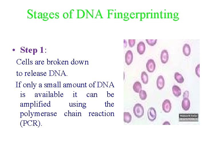Stages of DNA Fingerprinting • Step 1: Cells are broken down to release DNA.