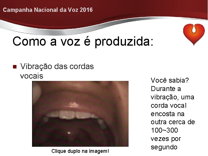 Campanha Nacional da Voz 2016 Como a voz é produzida: n Vibração das cordas