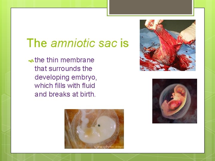 The amniotic sac is the thin membrane that surrounds the developing embryo, which fills