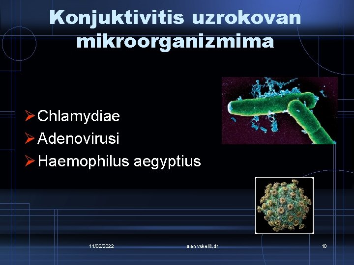 Konjuktivitis uzrokovan mikroorganizmima Ø Chlamydiae Ø Adenovirusi Ø Haemophilus aegyptius 11/02/2022 alen vukelić, dr