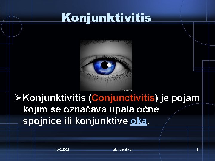 Konjunktivitis Ø Konjunktivitis (Conjunctivitis) je pojam kojim se označava upala očne spojnice ili konjunktive