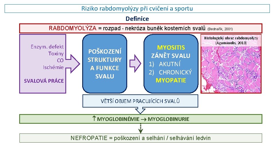 Riziko rabdomyolýzy při cvičení a sportu Definice RABDOMYOLÝZA = rozpad - nekróza buněk kosterních