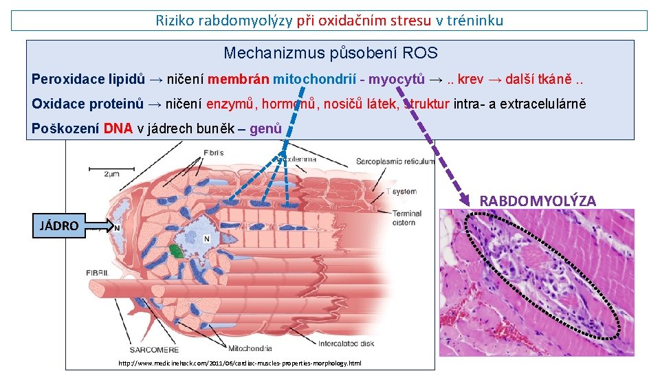 Riziko rabdomyolýzy při oxidačním stresu v tréninku Mechanizmus působení ROS Peroxidace lipidů → ničení