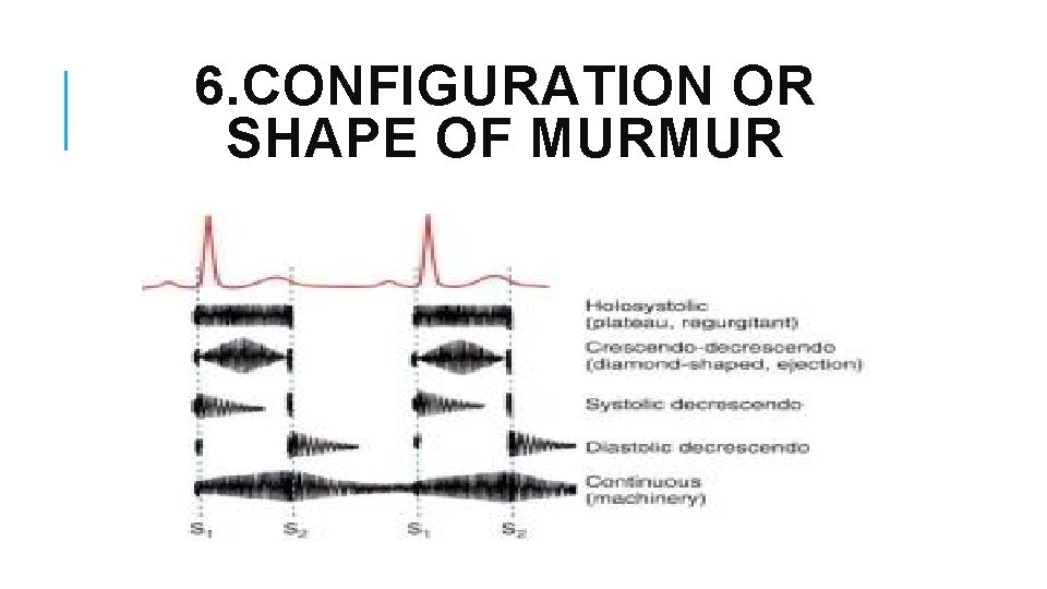 6. CONFIGURATION OR SHAPE OF MURMUR 