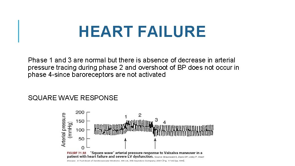 HEART FAILURE Phase 1 and 3 are normal but there is absence of decrease