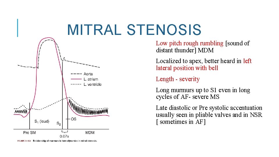 MITRAL STENOSIS Low pitch rough rumbling [sound of distant thunder] MDM Localized to apex,