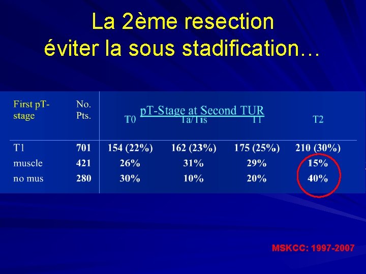 La 2ème resection éviter la sous stadification… MSKCC: 1997 -2007 