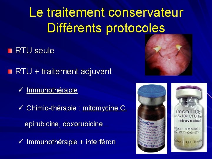 Le traitement conservateur Différents protocoles RTU seule RTU + traitement adjuvant ü Immunothérapie ü