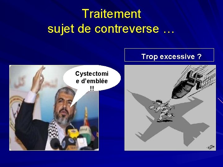 Traitement sujet de contreverse … Trop excessive ? Cystectomi e d’emblée !! 