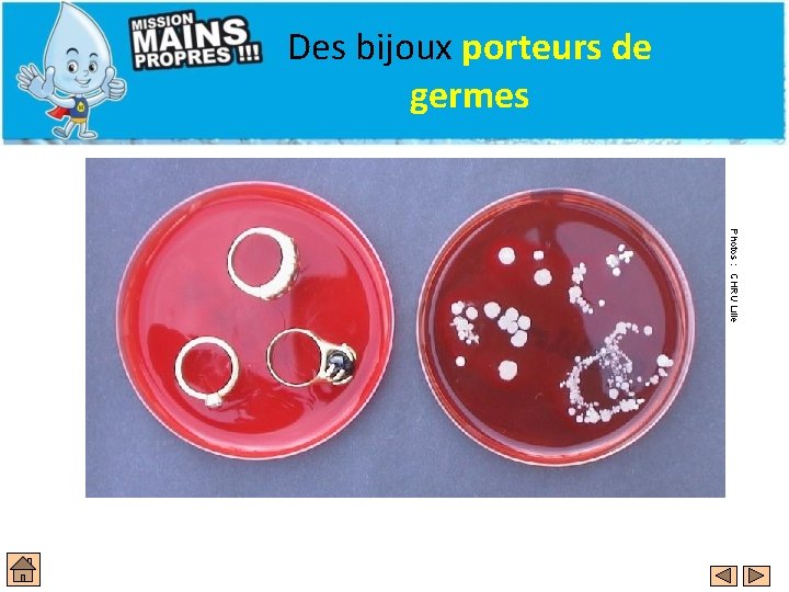 Des bijoux porteurs de germes Photos : CHRU Lille 