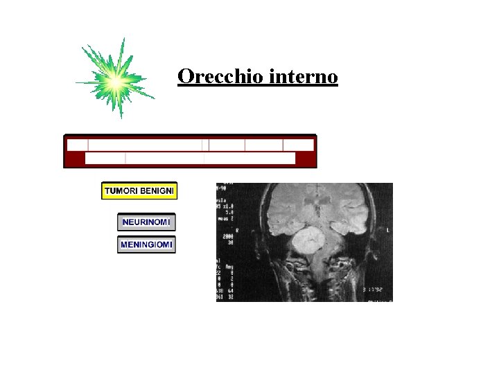 Orecchio interno 