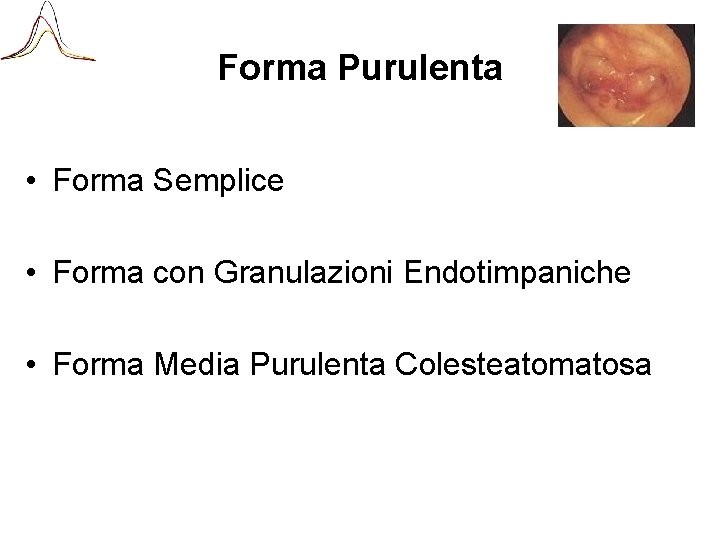 Forma Purulenta • Forma Semplice • Forma con Granulazioni Endotimpaniche • Forma Media Purulenta