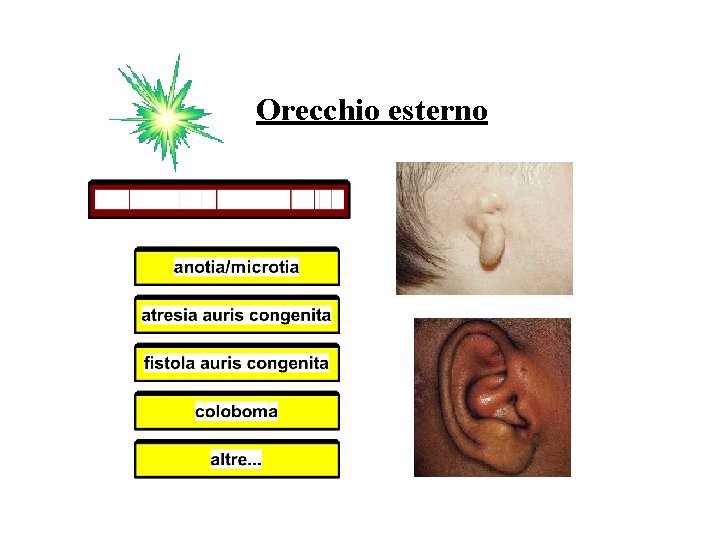 Orecchio esterno 