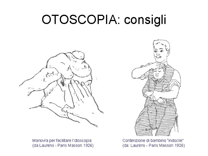 OTOSCOPIA: consigli Manovra per facilitare l’otoscopia (da Laurens - Paris Masson 1926) Contenzione di