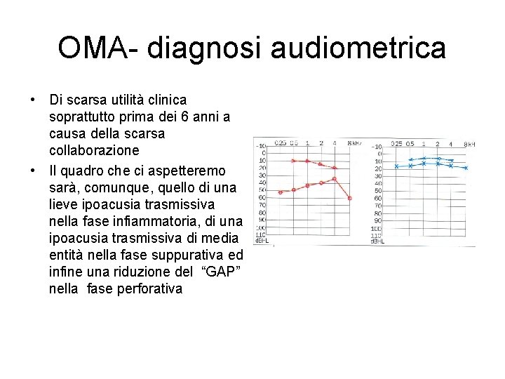 OMA- diagnosi audiometrica • Di scarsa utilità clinica soprattutto prima dei 6 anni a