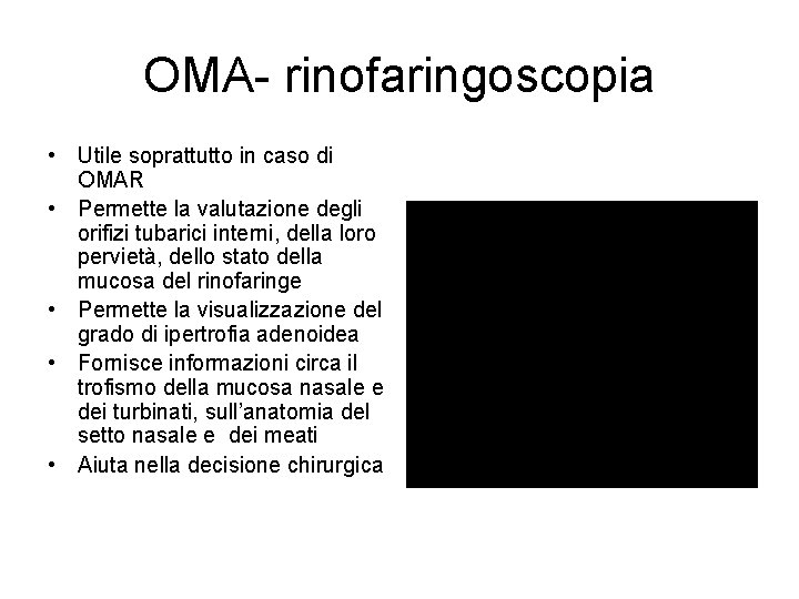 OMA- rinofaringoscopia • Utile soprattutto in caso di OMAR • Permette la valutazione degli