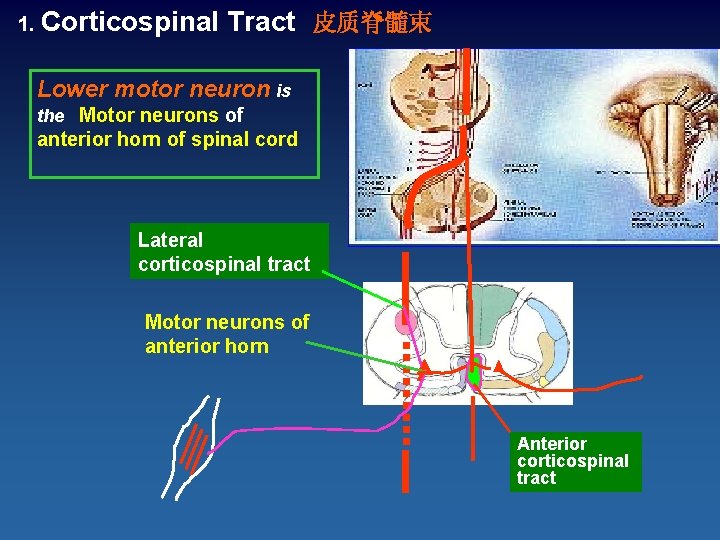 1. Corticospinal Tract 皮质脊髓束 Lower motor neuron is the Motor neurons of anterior horn