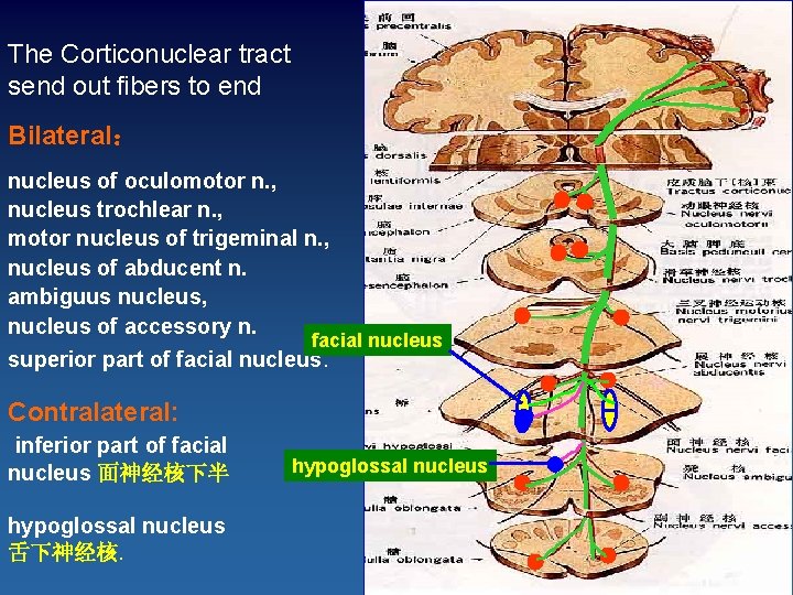 The Corticonuclear tract send out fibers to end Bilateral： nucleus of oculomotor n. ,