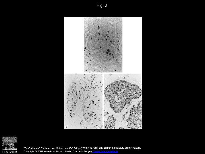 Fig. 2 The Journal of Thoracic and Cardiovascular Surgery 2002 124285 -292 DOI: (10.