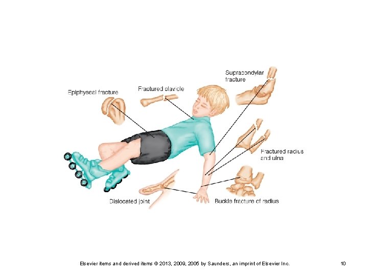 Elsevier items and derived items © 2013, 2009, 2005 by Saunders, an imprint of