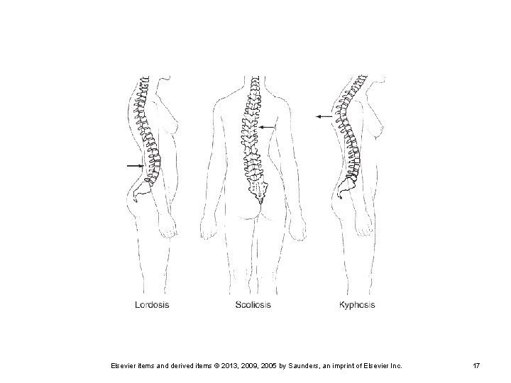 Elsevier items and derived items © 2013, 2009, 2005 by Saunders, an imprint of