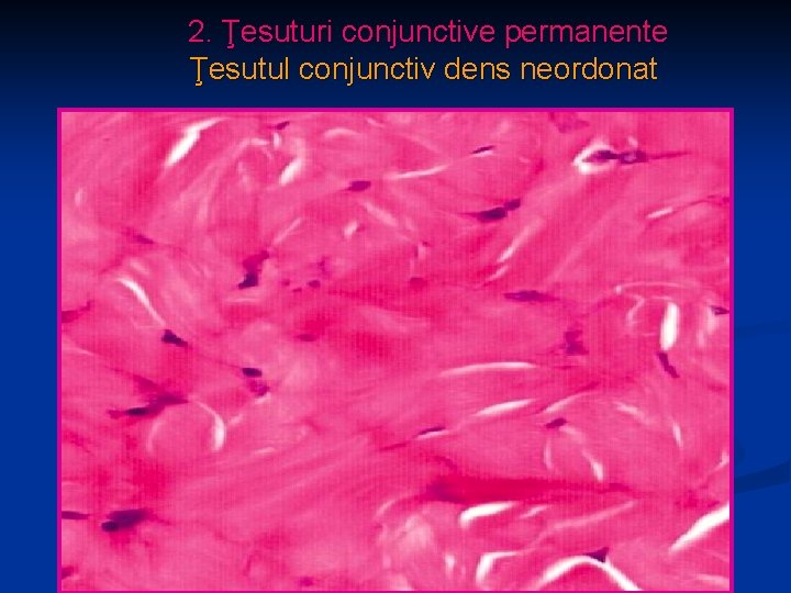 2. Ţesuturi conjunctive permanente Ţesutul conjunctiv dens neordonat 