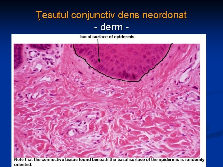 Ţesutul conjunctiv dens neordonat - derm - 