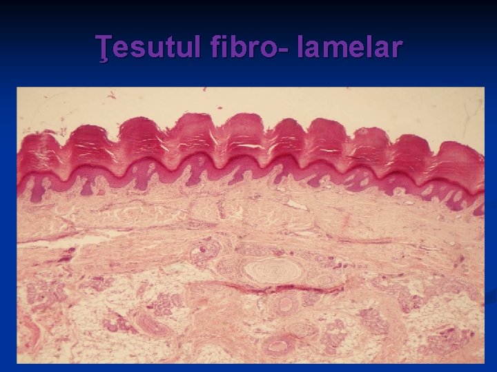 Ţesutul fibro- lamelar 